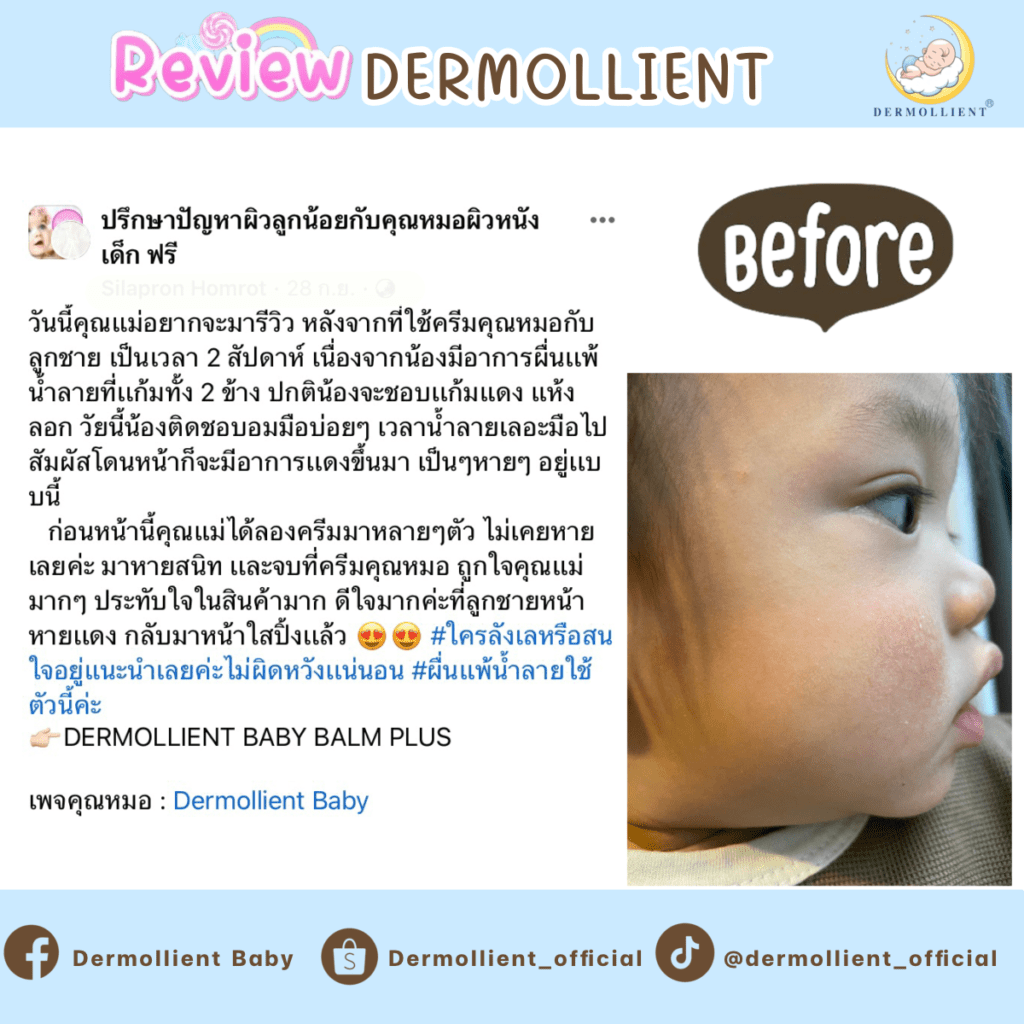 รีวิวผลิตภัณฑ์