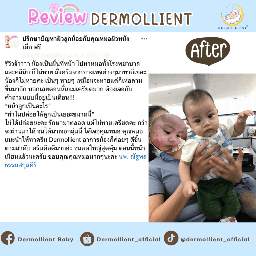 รีวิวผลิตภัณฑ์